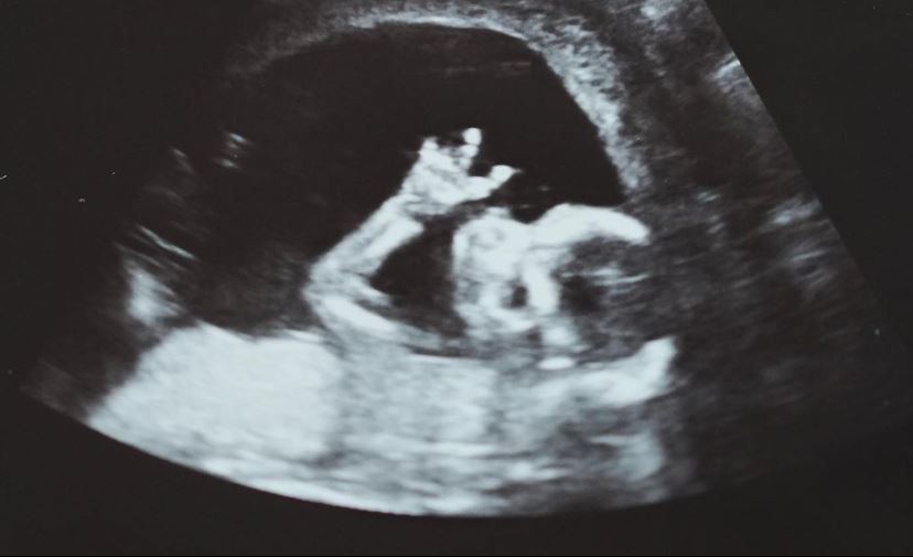 瘦子公開寶寶超音波照，證實自己要當爸了。圖／翻攝自Instagram＠mjfceo
