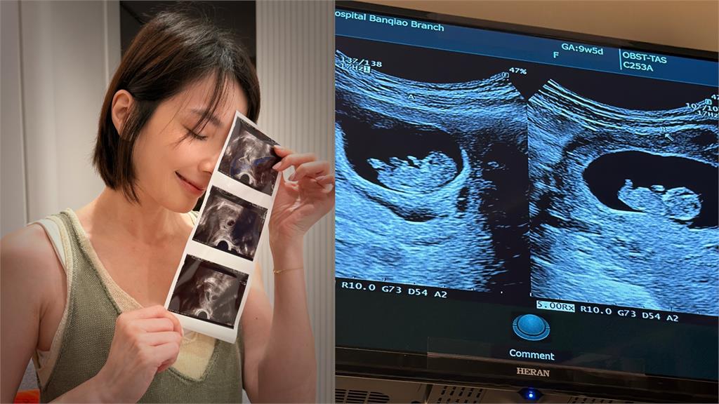 43歲湘瑩喜懷雙胞胎！秀超音波照甜喊：謝謝妳們選我當媽媽