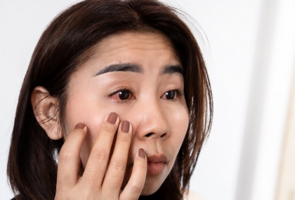過敏性結膜炎熱敷恐加重發炎！ 醫教「正確護眼法」：眼妝先別畫了