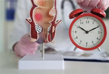 48歲工程師腹脹血便拖3月！健檢揪大腸癌 醫：年...