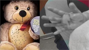玩發光投影玩具熊　7月嬰手掌二度燙傷