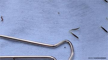 致死率15%！7旬男確診SFTS感染源不明 疾管...