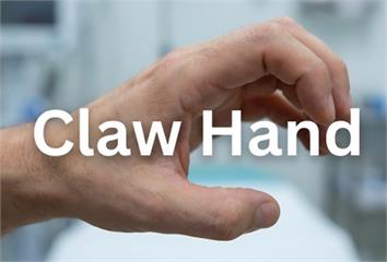 從握力、步速到平衡力  提早辨識才能守住獨立生活