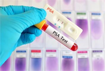 PSA升高不一定是癌 但也不能大意！攝護腺癌早期...