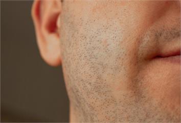 研究指「常刮鬍子更易染病」！ 專家列「5個鬍子整...