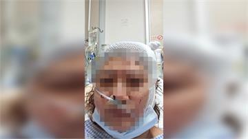 高雄科技廠女保全遭男友突襲猛砍 頭手重傷幸無礙