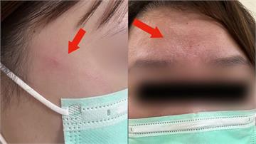 又傳醫療暴力！7旬翁加護病房發飆 打傷3護理師