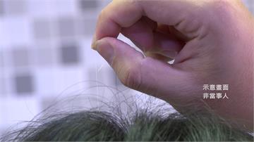 壓力大不只長白髮 醫曝恐皮膚炎「嚴重癌變」