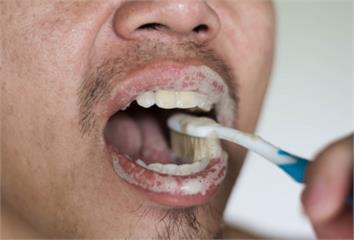 刷牙「1位置」多數人都刷不乾淨！ 牙醫點破「錯誤...