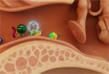 慢性中耳炎未控 75歲翁併發膽脂瘤侵蝕顱底、顏面...