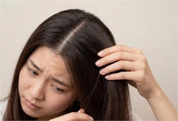 減肥害頭髮狂掉？醫揭「飲食4大地雷」  很多人沒...
