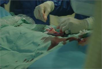 心導管檢查血管通路怎麼選？從股動脈到橈動脈 醫揭...