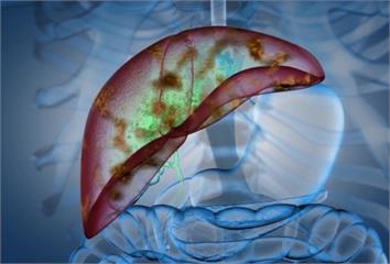 醫警告「4習慣不改」恐突然爆猛爆性肝炎！ 天天吞...