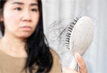 每天洗頭都掉一堆頭髮？醫曝「5元兇」髮量愈來愈稀...
