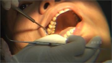 刷牙「見血」莫輕忽 牙周病恐致牙根蛀牙