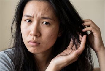 起床就梳頭竟是地雷！醫揭「4習慣」害頭髮愈掉愈多  一票人全中