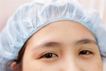 眼袋手術效果能維持多久？醫揭真相 做好這1件事撐...