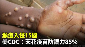 猴痘入侵15國、百例確診 專家：兒童、孕婦慎防重...