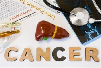 一半肝癌症患發現時皆晚期 2類人為高風險群 1療...