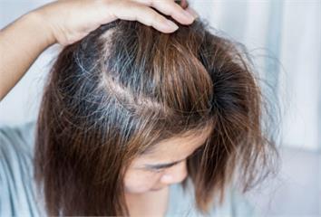 植髮毛囊「後枕、側枕、鬍鬚」取哪裡最好？ 醫揭存...