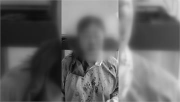洗牙太痛？ 21歲男暴怒「痛毆女牙醫」診所濺血