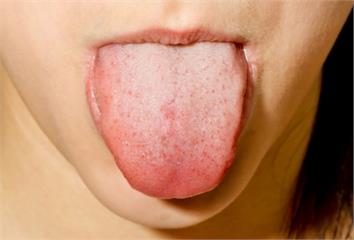 舌頭痛小心是自律神經失調！ 含冰水、吃2類食物都...