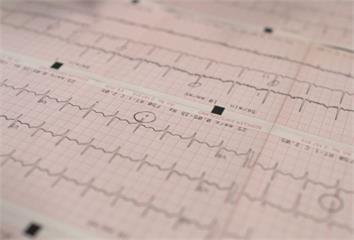 心房顫動中風風險怎麼評估？臺大AI模型助攻個人化...
