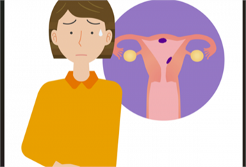 停經後出血別輕忽！55歲婦人誤以為更年期 竟確診子宮內膜癌一期