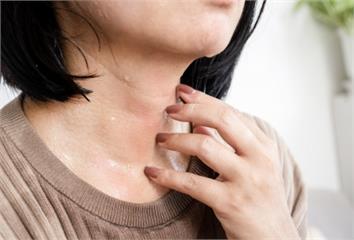 夏天汗多恐致泌尿道感染！醫揭「關鍵原因」 做好這...