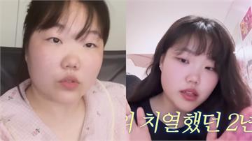 AKMU秀賢挺過低潮暴瘦30KG 曝親哥「魔鬼訓...