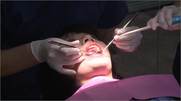 重度牙周病、廣泛缺牙 與失智症有強烈關聯
