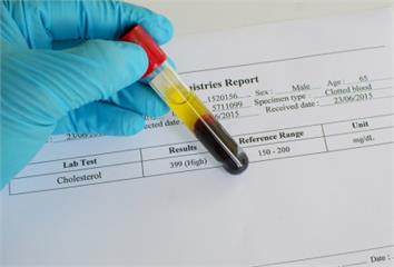 壞膽固醇失控爆危機 這5種疾病都會蠢蠢欲動