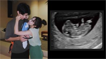 恭喜！吳姍儒喜曬「超音波」照宣布懷孕五個月