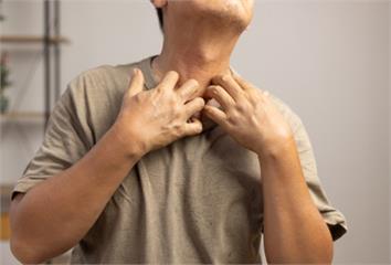 天一冷就皮膚癢？醫揪「罪魁禍首」  洗澡水溫、乳...