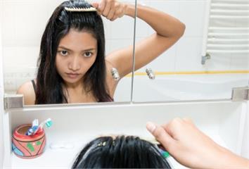 戴假髮反害更禿？ 醫揭「4地雷」超多人踩  很難...