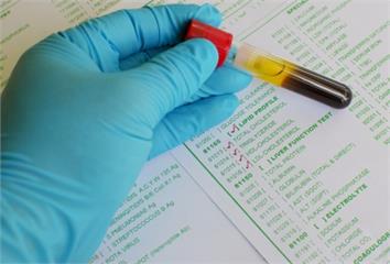 「餐後血脂」比你想的更危險！營養師推3急救食物 ...