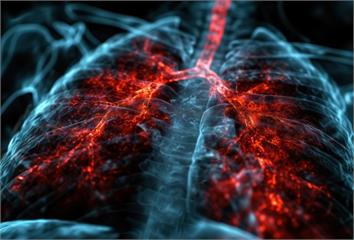 肺結節不等於肺癌！醫師：多數不必急著開刀 LDC...