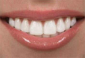 一口黃牙變白只是傳說？牙齒美白方法有2種 5族群...