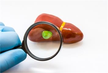 腹痛別硬撐！醫警告：恐是膽囊炎 「這2症狀」和結...