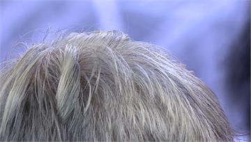 「長白髮」代表正在防癌？ 日本研究揭驚人真相