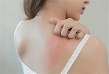 很多人為了健康「戒吃這1物」反害皮膚更乾癢！醫示...