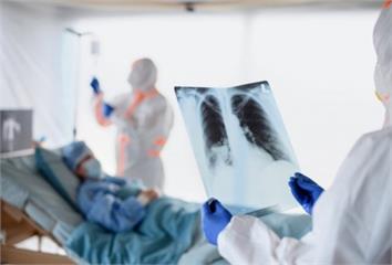 肺炎不只一種！細菌、病毒、吸入異物或免疫低下皆可...