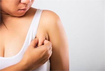 怎麼瘦都有副乳？醫揭「4大元凶」  試試這幾個改...