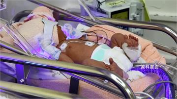 胎兒過敏化日趨嚴重　台中3成嬰兒過敏數值過高