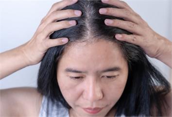 你的壽命長不長？醫揭「頭髮5線索」自測    過...