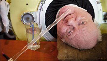 美國「鐵肺人」離世！ 70多年鐵肺生活創世界紀錄