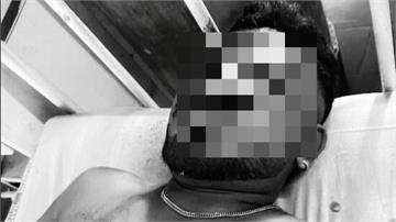 印航空難1英國籍男奇蹟生還　警方：他座位緊靠逃生...