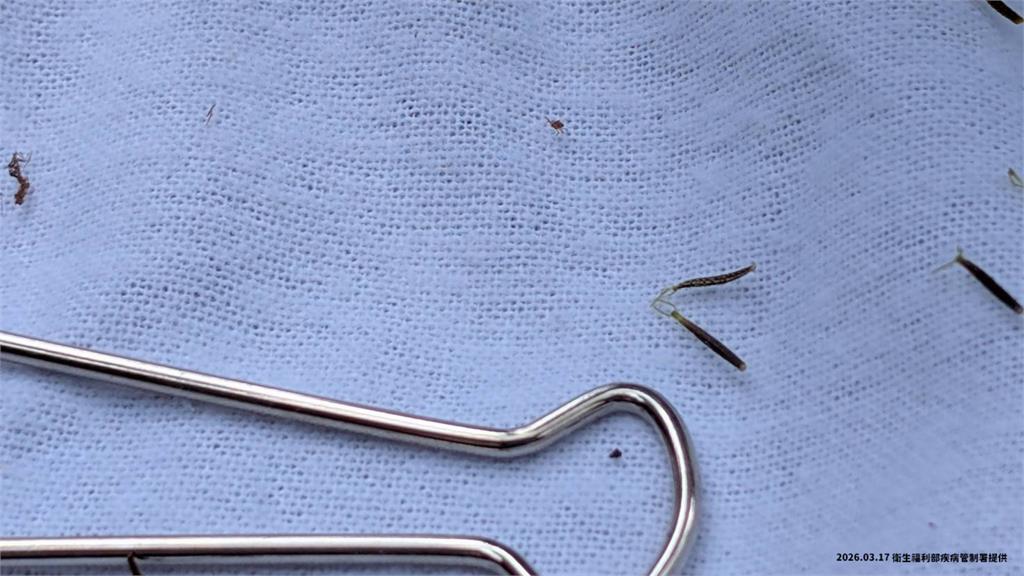 致死率15%！7旬男確診SFTS感染源不明 疾管署急匡列9人