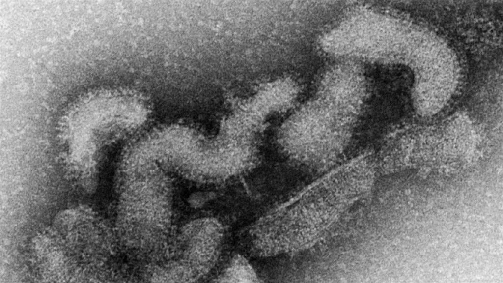 OZ病毒。圖／翻攝自日本國立感染症研究所提供