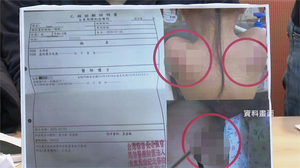 台東學前特教班虐童案裁罰出爐！ 涉案師解聘終身不得任用